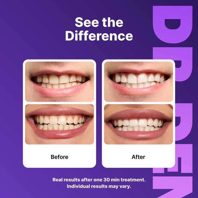 No-Slip Teeth Whitening Strips, Gentle Peroxide-Free Formula for Coffee & Tea Stains-TTT