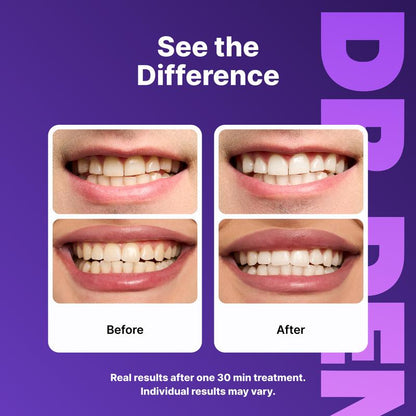 No-Slip Teeth Whitening Strips, Gentle Peroxide-Free Formula for Coffee & Tea Stains-TTT