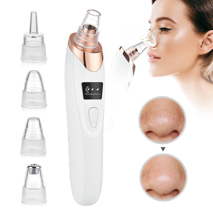 Say Goodbye to Strawberry Nose! Reveal Flawless, Radiant Skin in Just 3 Simple Steps.-DZT