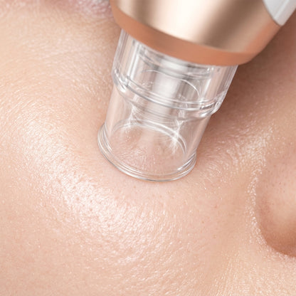 Say Goodbye to Strawberry Nose! Reveal Flawless, Radiant Skin in Just 3 Simple Steps.-DZT