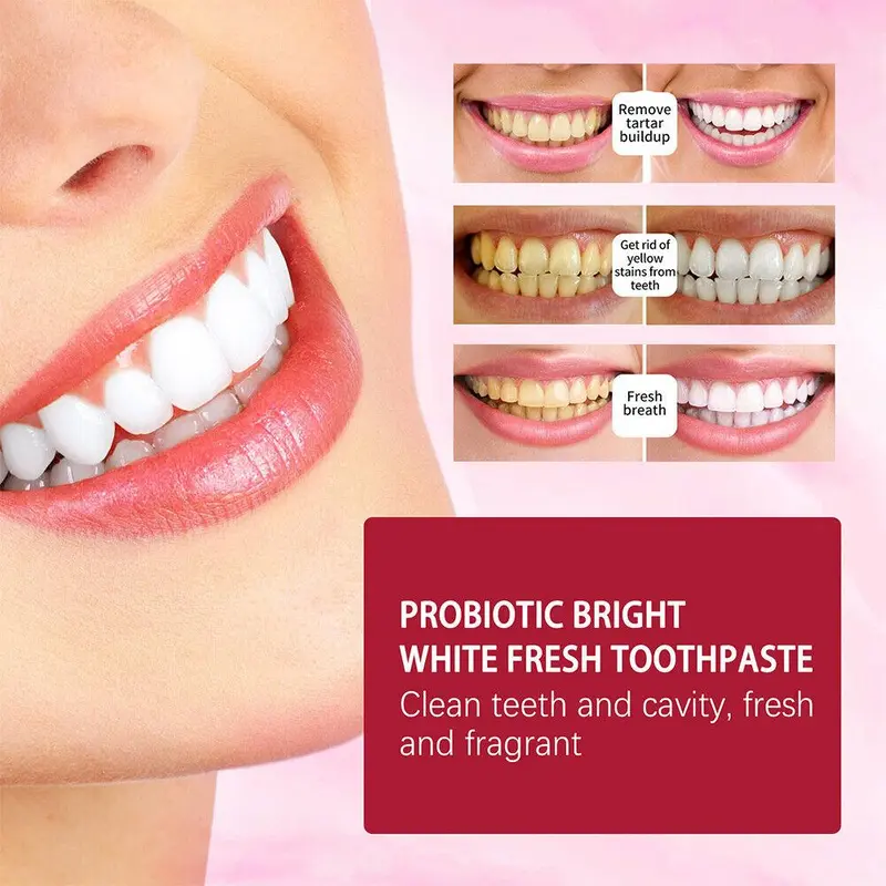 🦷SP-4 Probiotic Gum Care &amp; Whitening Toothpaste-CJP