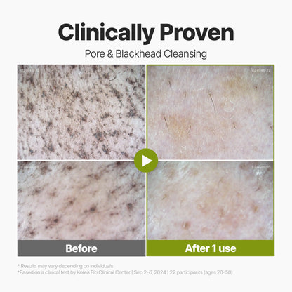 Stop Squeezing Your Pores! Meet the Viral K-Beauty Bubble Mask That Does the Work for You.-DZT