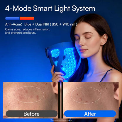 Deep repair, lifting and firming for lasting radiance. 4D tailored design sculpts the jawline with cooling soothing comfort. Wireless, lightweight and ultra-comfortable to wear, perfect as a thoughtful Mother’s Day gift.-KPL