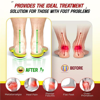 High Arch Support Orthotic Insoles For Men Women,Plantar Fasciitis Insoles,Work Boot Insoles For Standing All Day,Shock Absorbing Heavy Duty Support Relief Foot Pain,Orthotic Flat Feet,Heightening Insole,Chef,Food Service,Shoe Inserts,Sweat Footwear-AUX