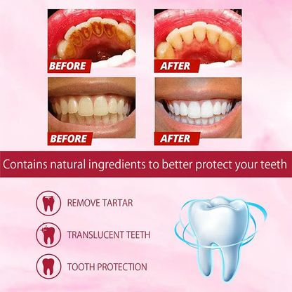 🦷SP-4 Probiotic Gum Care &amp; Whitening Toothpaste-CJP
