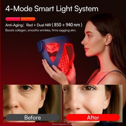 Deep repair, lifting and firming for lasting radiance. 4D tailored design sculpts the jawline with cooling soothing comfort. Wireless, lightweight and ultra-comfortable to wear, perfect as a thoughtful Mother’s Day gift.-KPL