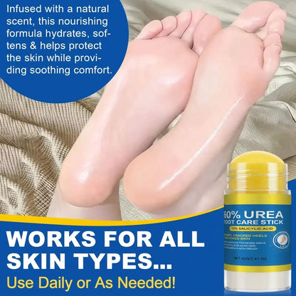 60% High-Purity Urea + 2% Salicylic Acid Foot Care Stick-DZT