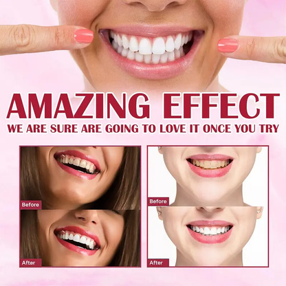 🦷SP-4 Probiotic Gum Care &amp; Whitening Toothpaste-CJP