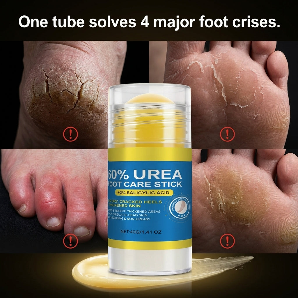 60% High-Purity Urea + 2% Salicylic Acid Foot Care Stick-DZT