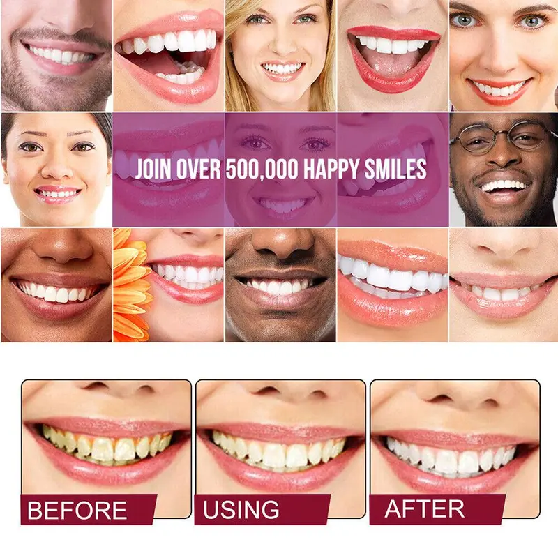🦷SP-4 Probiotic Gum Care &amp; Whitening Toothpaste-CJP