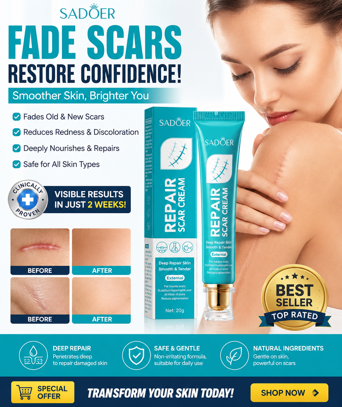 Advanced Scar Repair Cream  Fade Old & New Scars | Smooth & Restore Skin-SUY