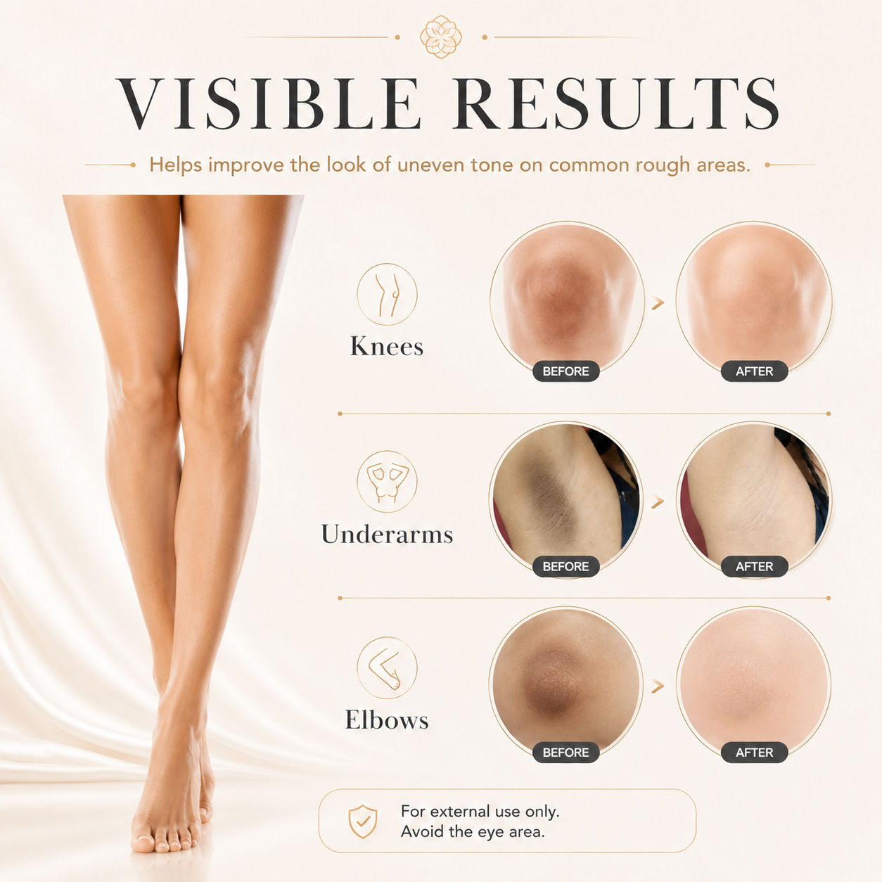 🥰Brightening Cream – Targets melanin and dark spots all over the body, evens skin tone and lightens your skin-YOY